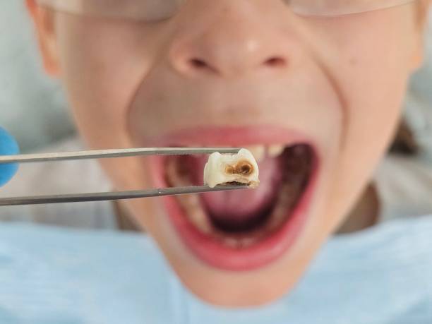 Best Emergency Broken Tooth Repair in West Fairview, PA